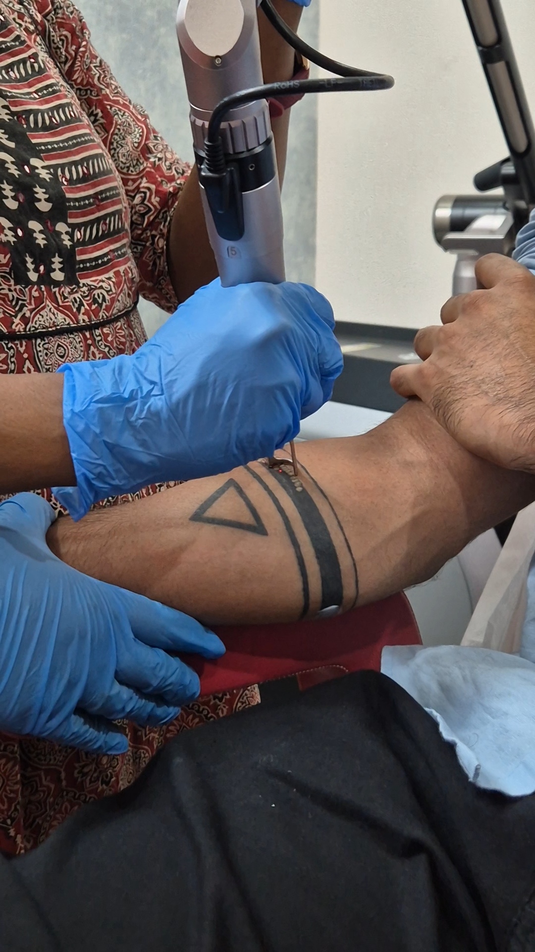 Skin treatment at Dermats