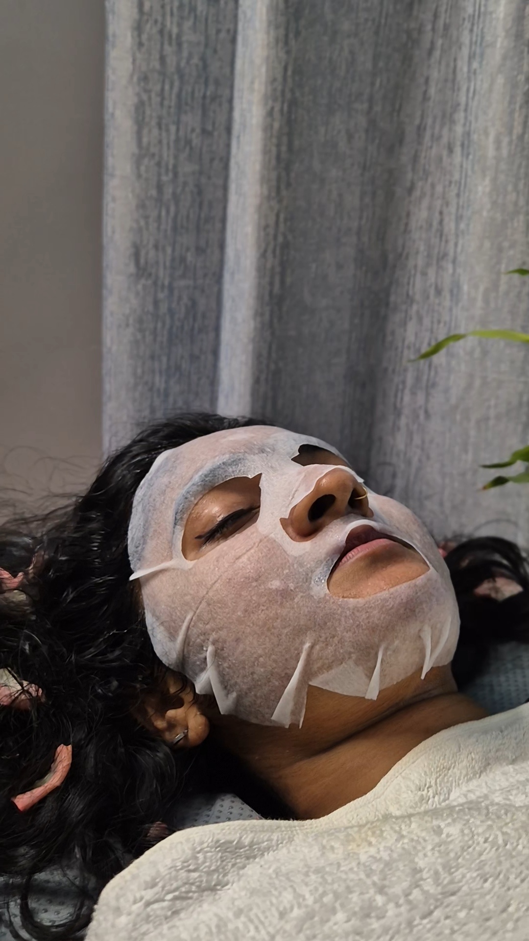 Skin treatment at Dermats