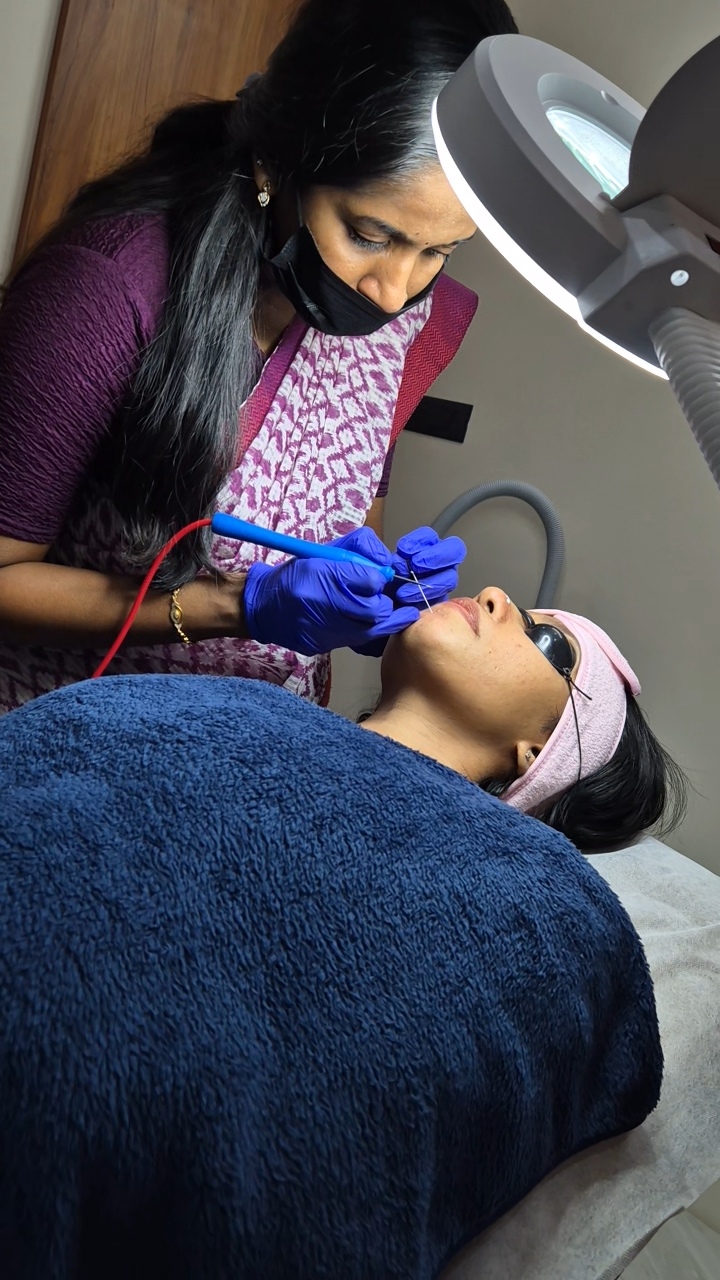Skin treatment at Dermats
