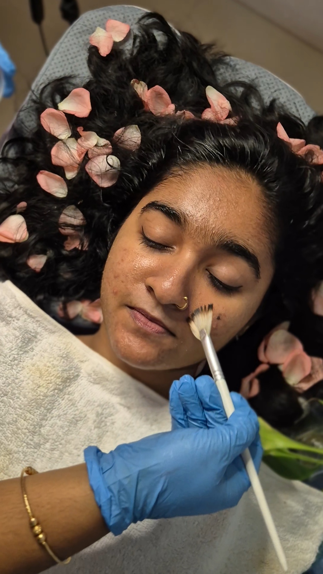 Skin treatment at Dermats