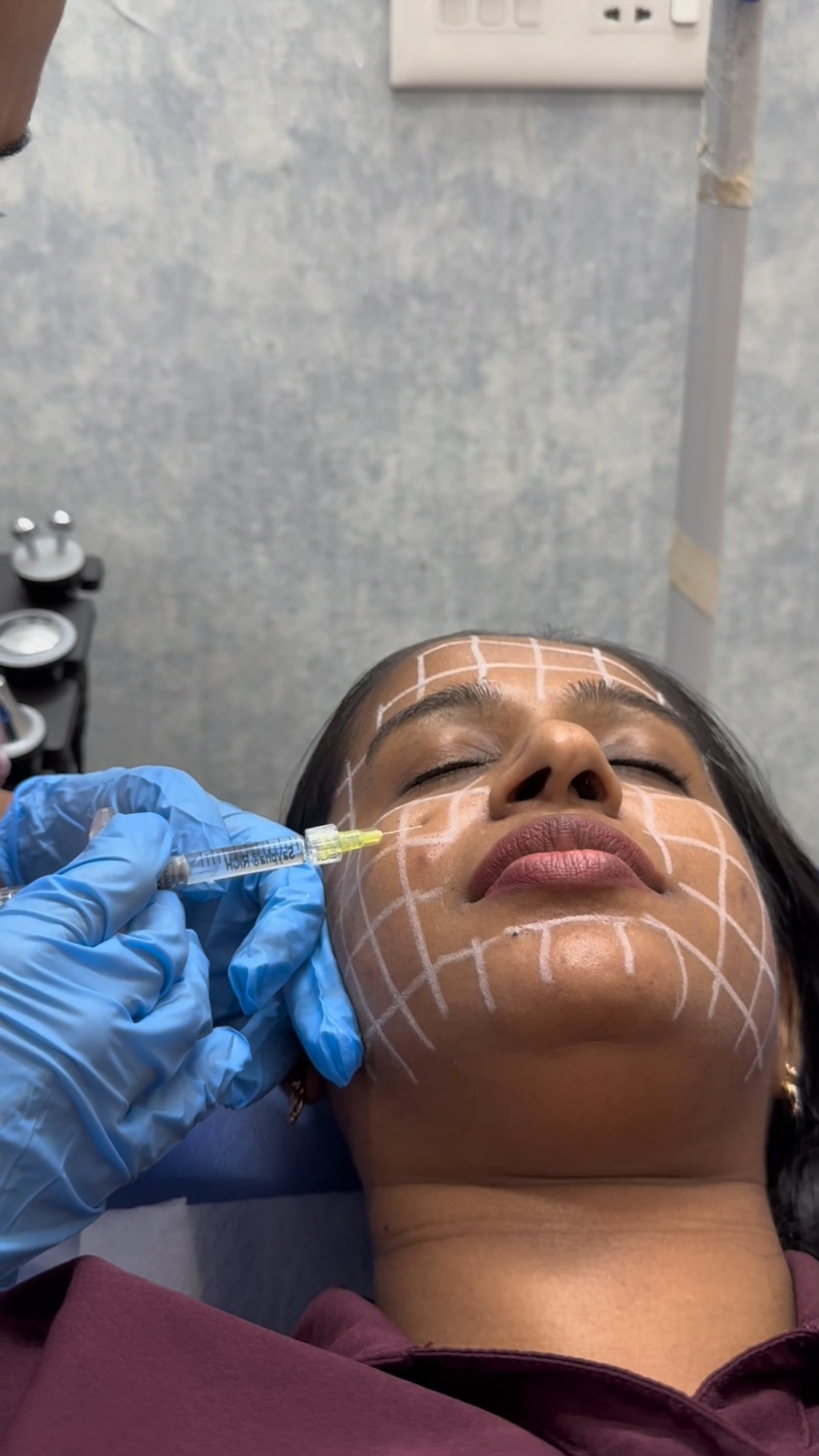 Skin treatment at Dermats