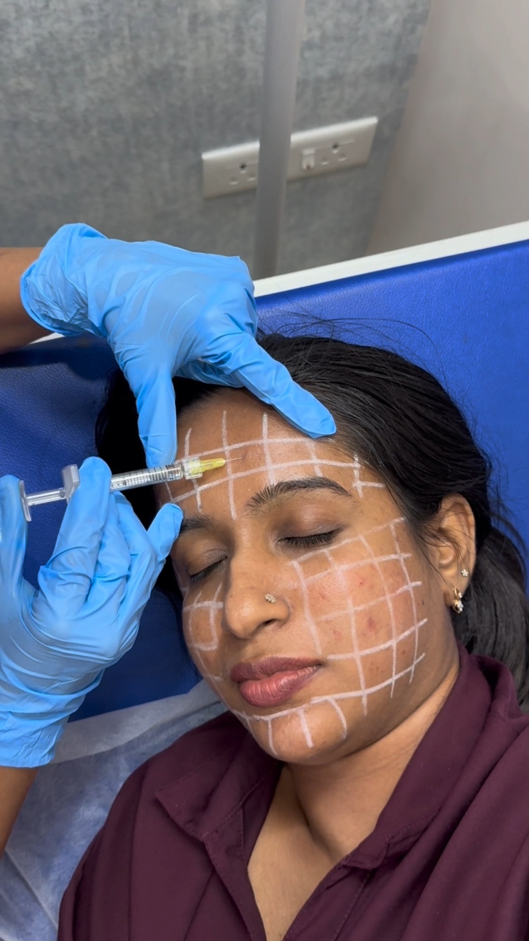 Skin treatment at Dermats