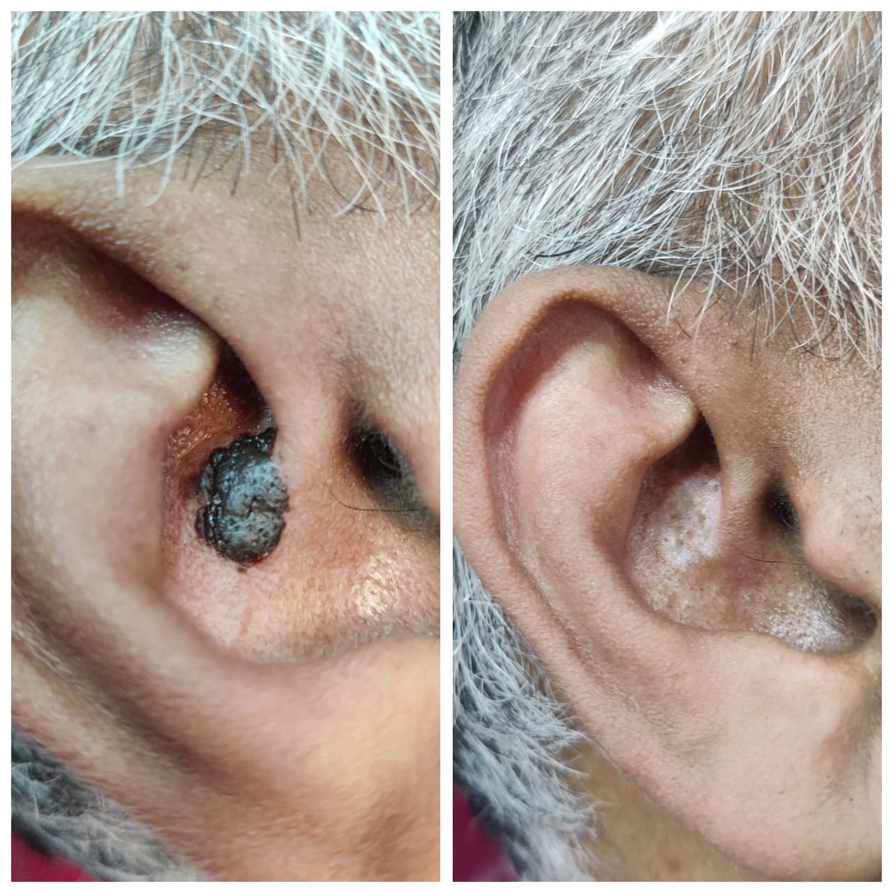 Before and After