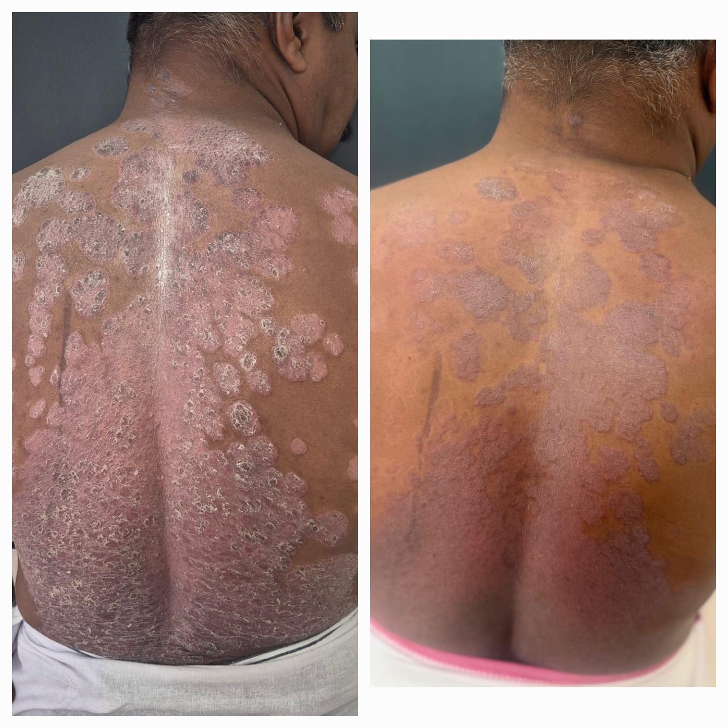 Before and After