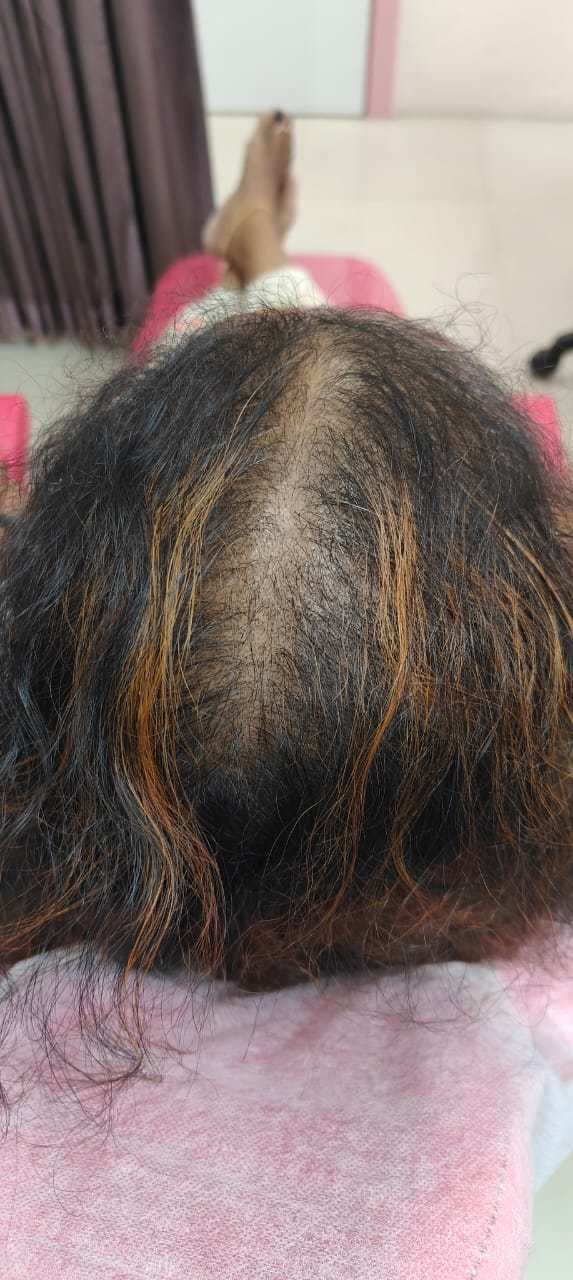After Treatment