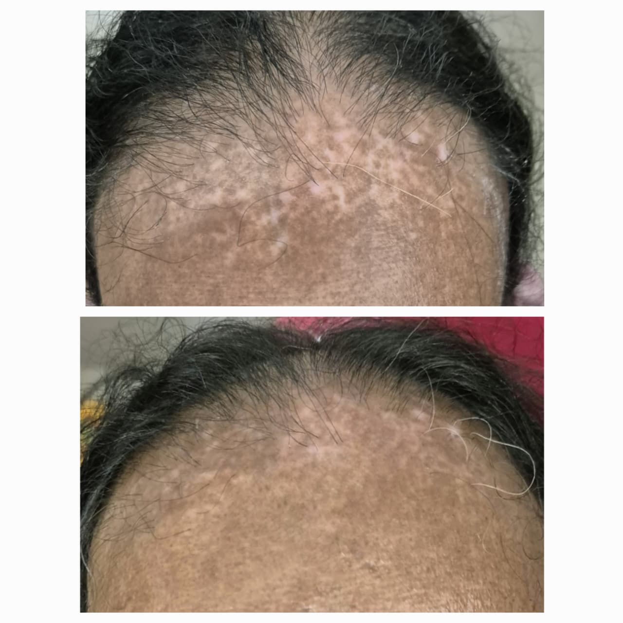 Before and After