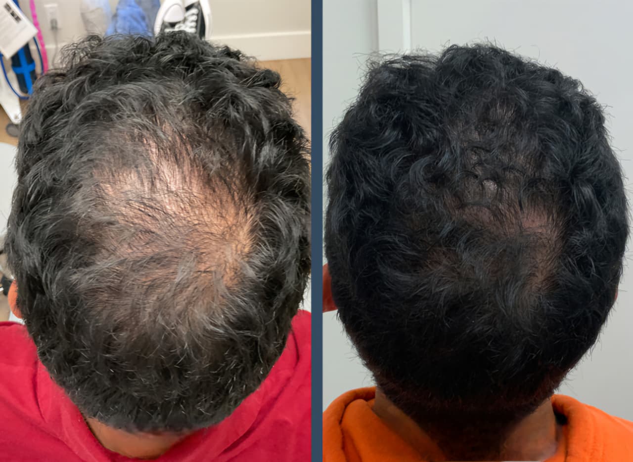 Before and After
